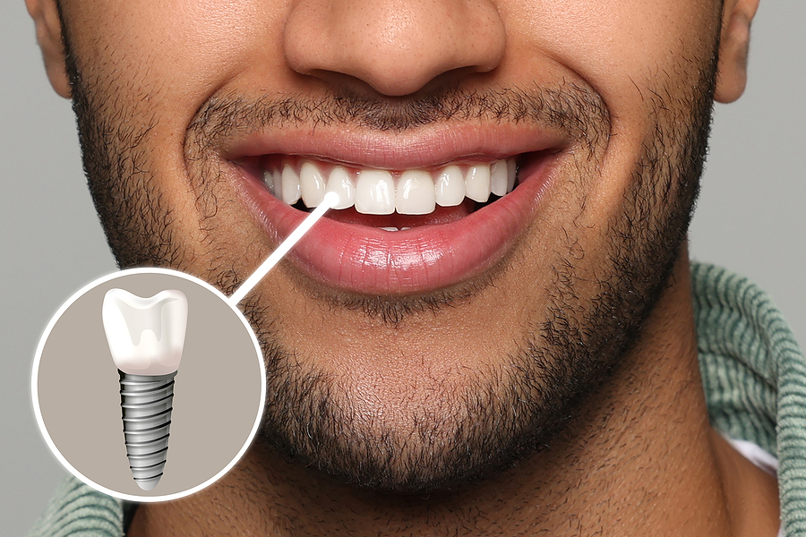 Happy Man With Perfect Teeth Smiling On Grey Background, Closeup